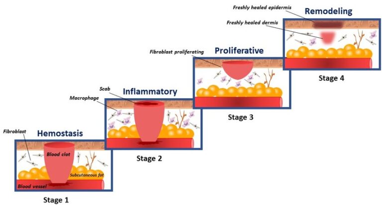 Wound healing efficacy: physiological mechanism and in vitro validation ...